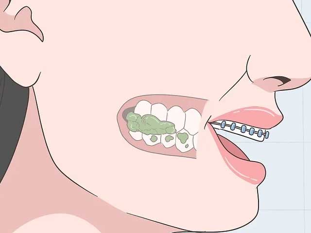 با دندان‌های عقب خود غذا را بجوید.