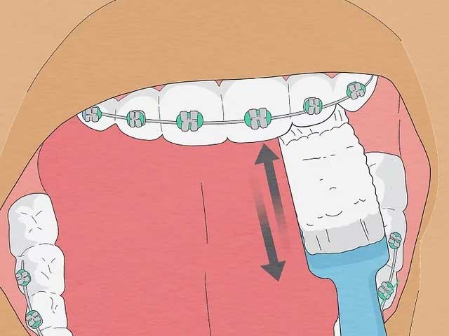 قسمت داخلی دندان‌های خود را مسواک بزنید