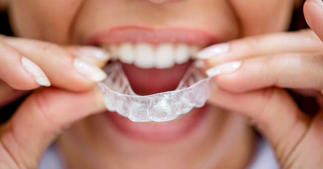 روشهای درمانی دندان کج