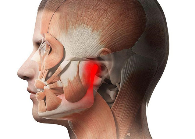 آشنایی با علائم اختلال مفصل گیجگاهی فکی (TMJ)