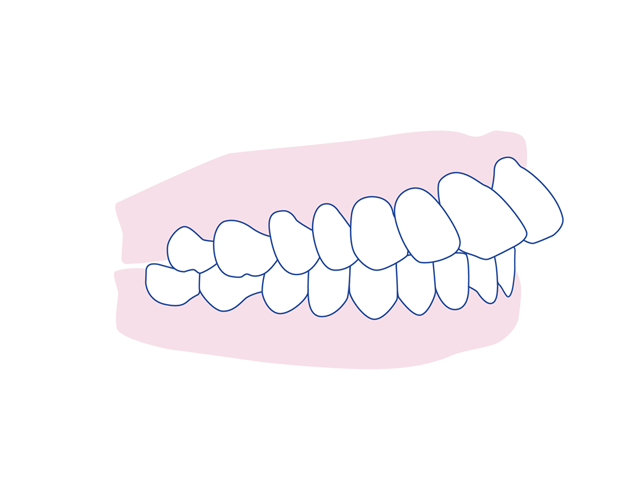 اورجت دندان