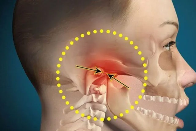 درمان اختلال مفصل گیجگاهی فکی(TMJ) با ارتودنسی