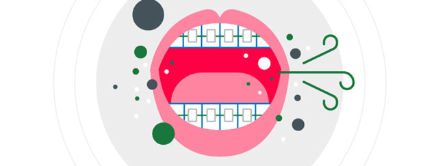 علل احتمالی بوی بد دهان در هنگام استفاده از ارتودنسی چیست؟
