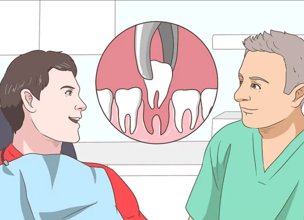 کشسدن دندان و درمان آندربایت