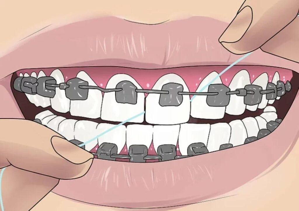 حالا از نخ دندان به صورت قبل استفاده نمایید.