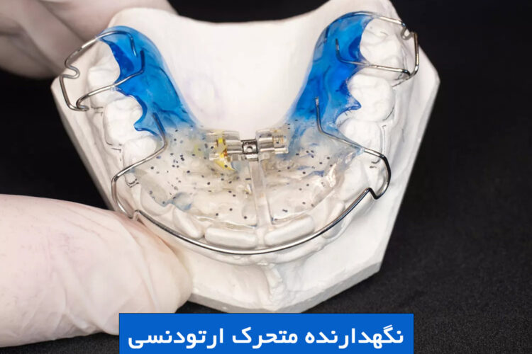 نگهدارنده متحرک ارتودنسی