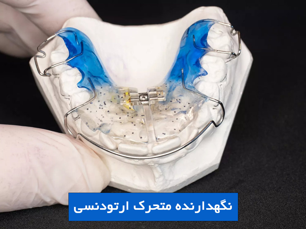 نگهدارنده متحرک ارتودنسی
