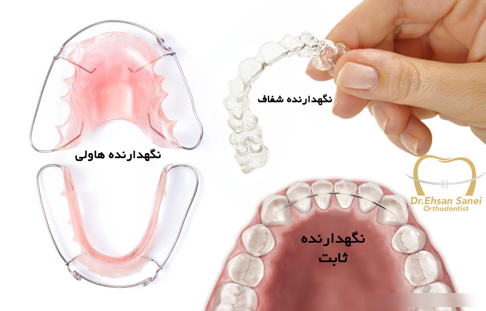 نگهدارنده متحرک ارتودنسی