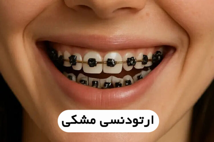 ارتودنسی مشکی