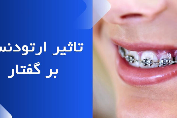 تاثیر درمان ارتودنسی بر گفتار(لکنت و صحبت نوک زبانی)
