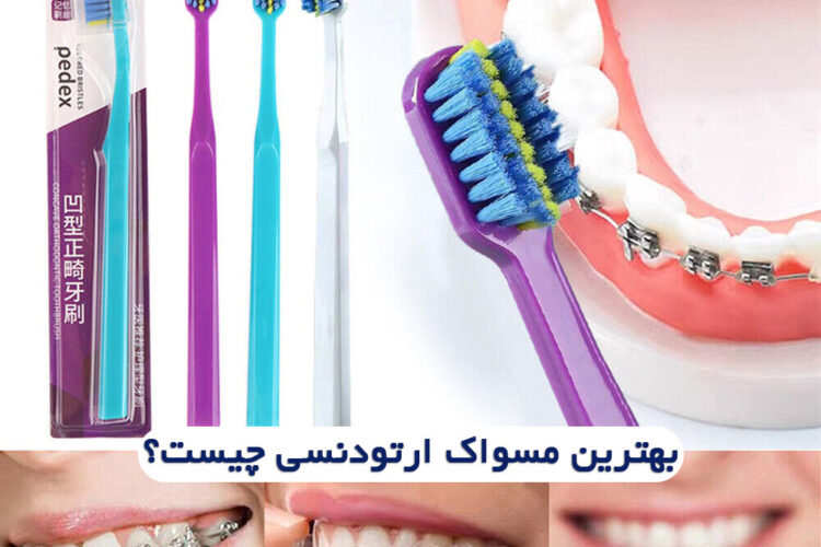 بهترین مسواک برای ارتودنسی