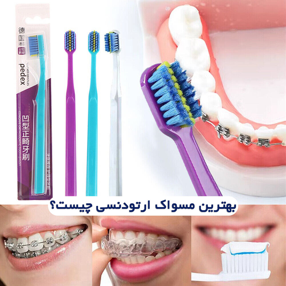 بهترین مسواک برای ارتودنسی
