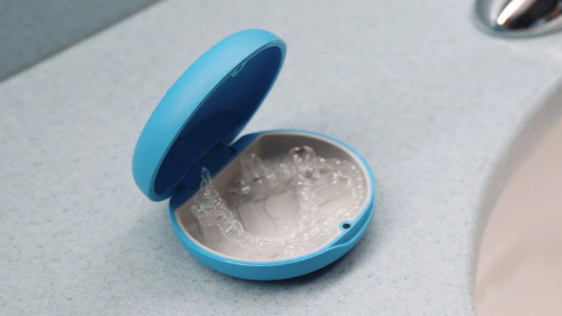 محافظت از نگهدارنده