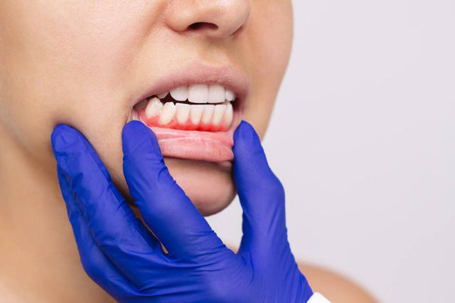 بیماری پریودنتال و اهمیت آن