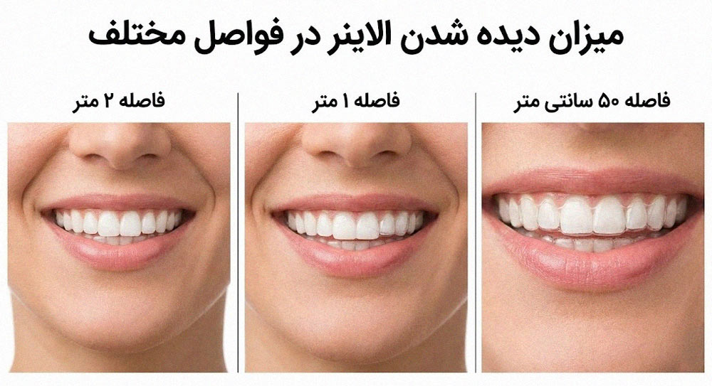 قایسه میزان دیده شدن الاینر شفاف از فاصله ۲ متری و نزدیک