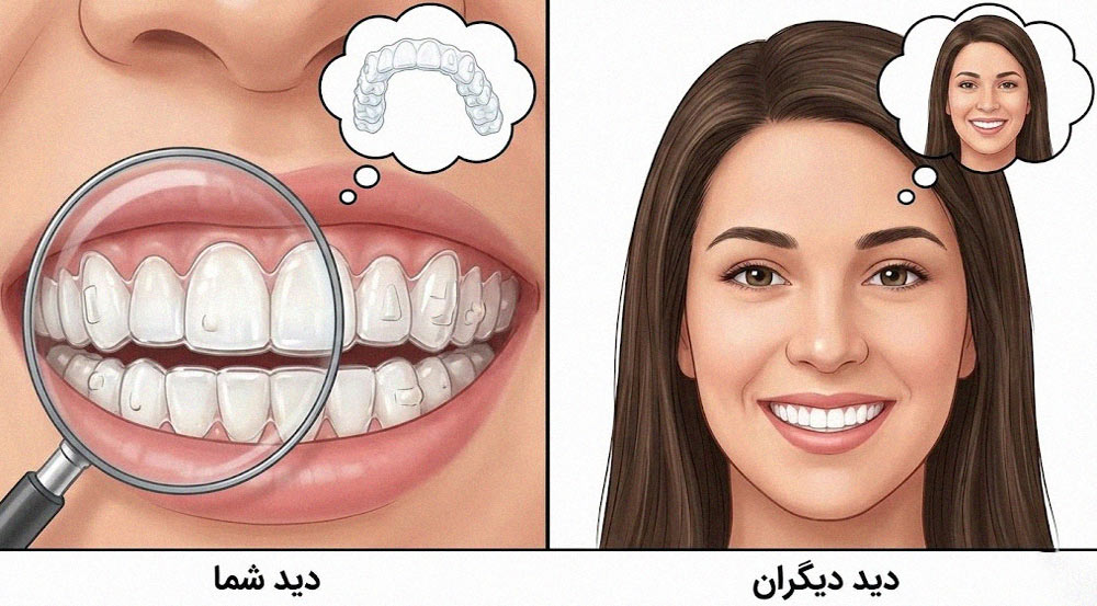 تفاوت دید خود فرد و اطرافیان نسبت به ارتودنسی نامرئی