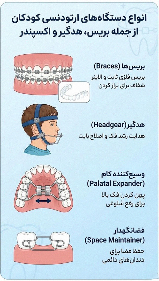 اینفوگرافیک انواع دستگاههای ارتودنسی کودکان؛ بریس، هدگیر، وسیعکننده کام، فضانگهدار