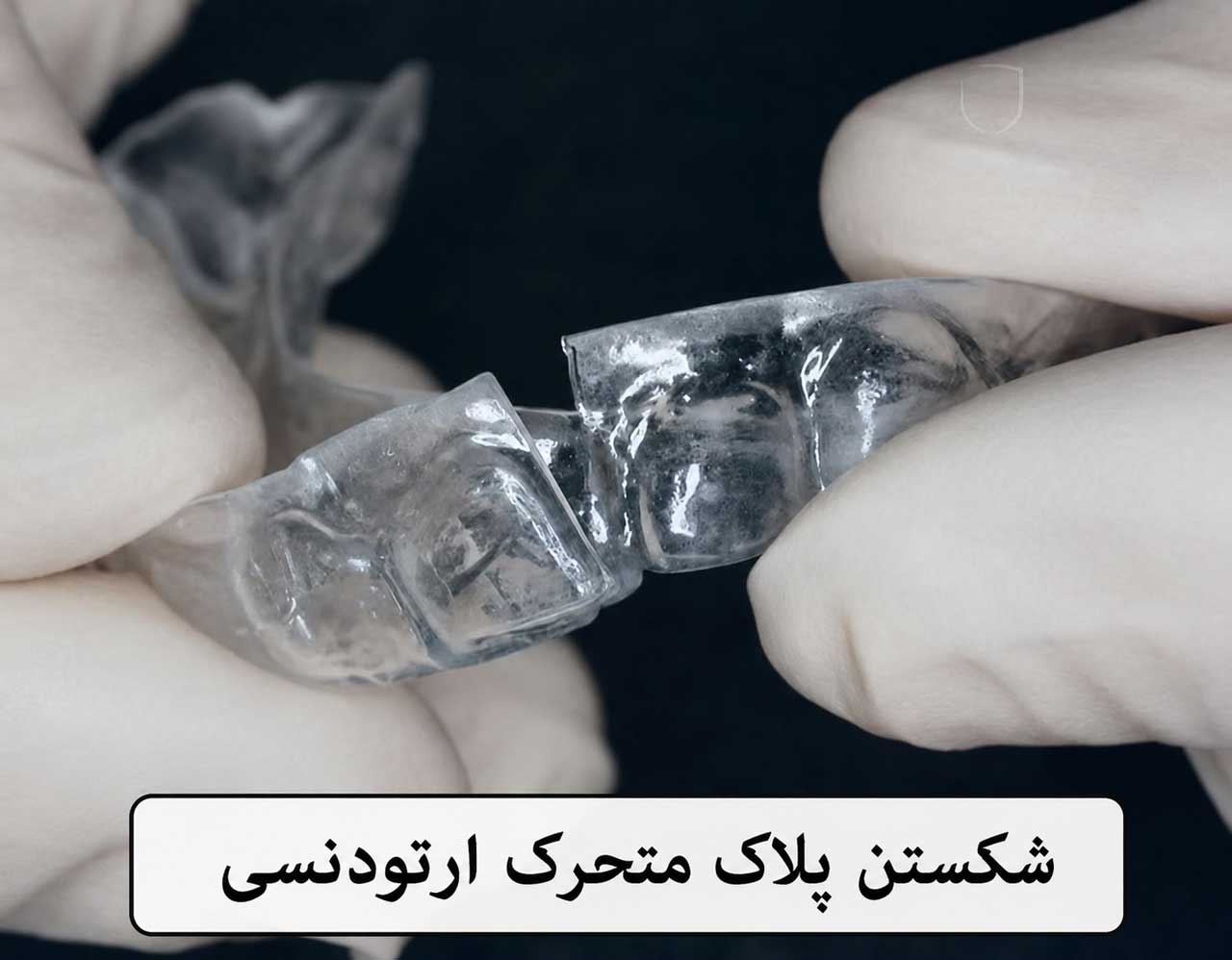 شکستن پلاک متحرک ارتودنسی