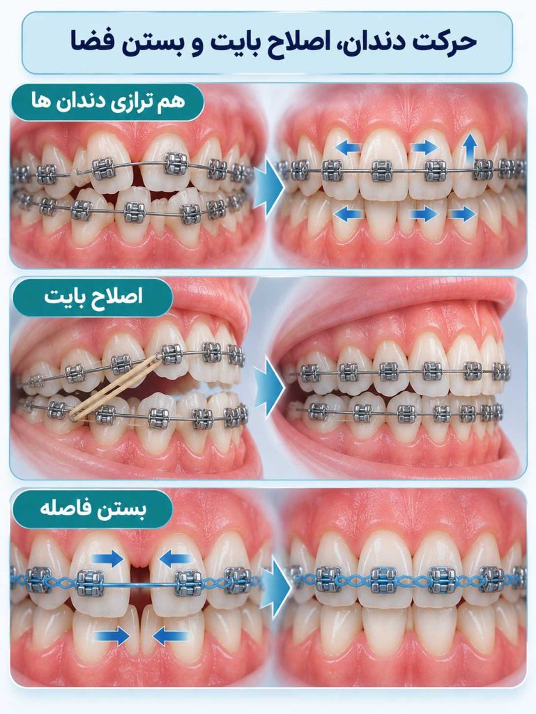 اصلاح بایت