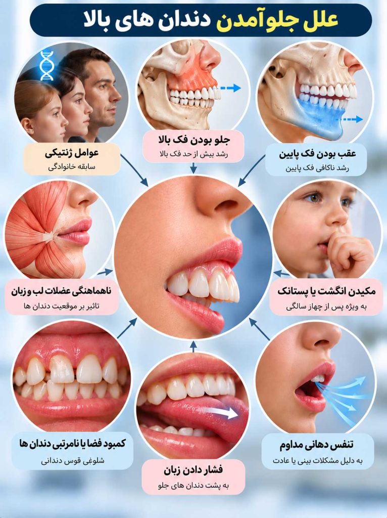 دلایل بوجود آمدن دندان خرگوشی