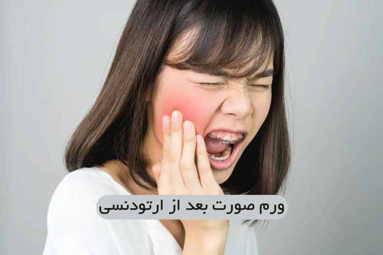 ورم صورت بعد از ارتودنسی